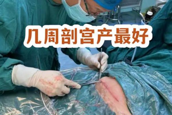 实操:8月剖腹产选日子指南,如何挑选对母婴都好的吉日? 实操:8月剖腹产选日子指南,如何挑选对母婴都好的吉日?