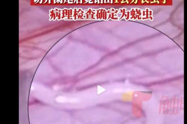 梦见身上掉下来很多虫子