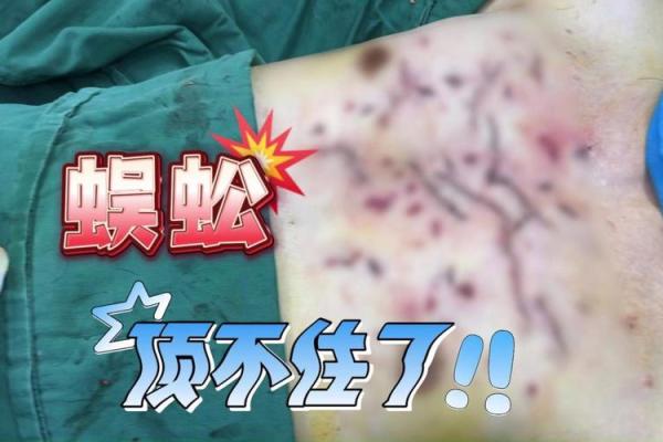 梦见自己身体里面有好多虫子