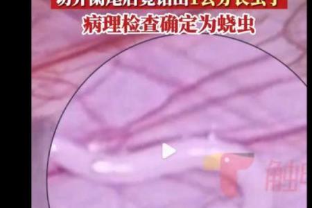 梦见身上掉下来很多虫子