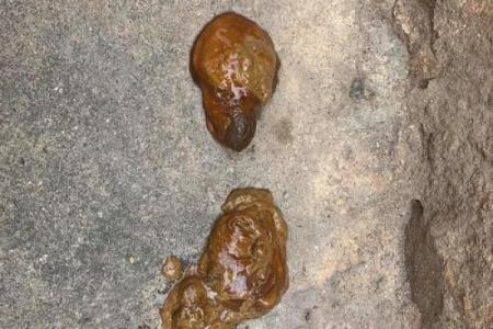 梦见自己儿子拉屎是什么意思