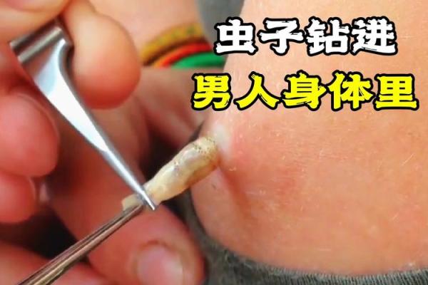 梦到自己身上长虫子怎么回事