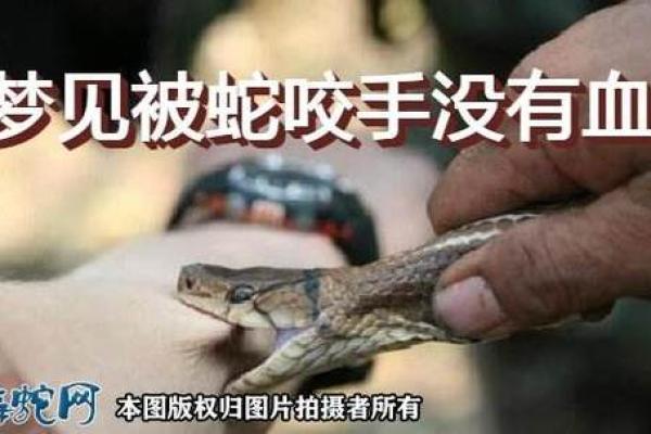 梦见蛇咬儿子是什么意思