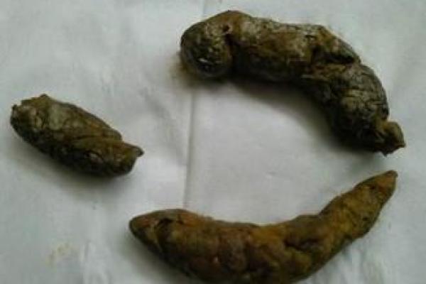 梦到身上有屎