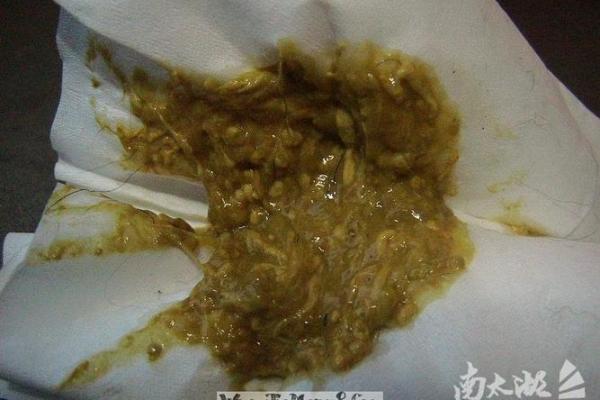 梦见自己的女儿拉屎是什么意思