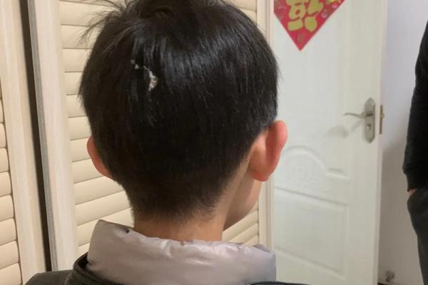 梦见鸟屎掉身上