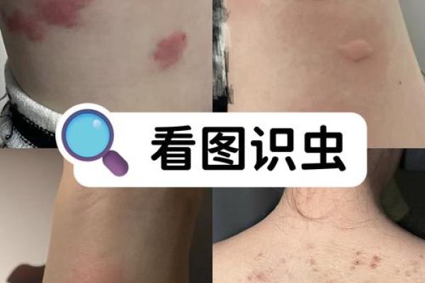 梦到身上很多虫子弄不干净