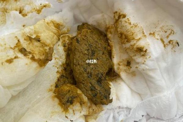 梦见把屎弄在身上是什么意思