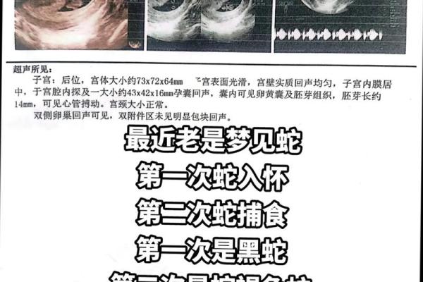 孕妇梦到小黑蛇