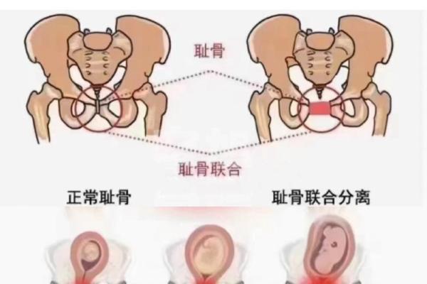 女性耻骨高的风水(耻骨高的女人性格特点)