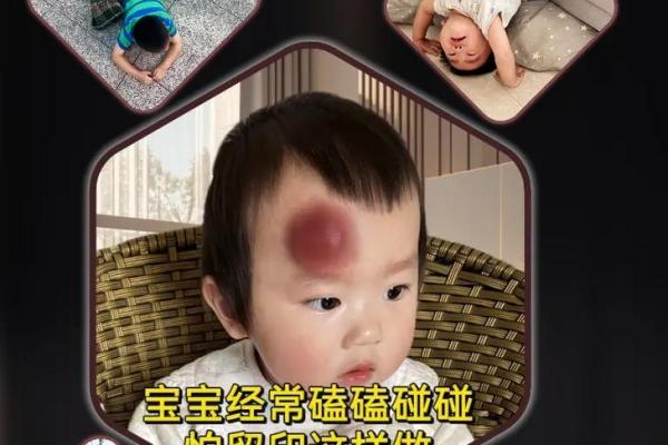 梦见儿子受伤了是什么预兆
