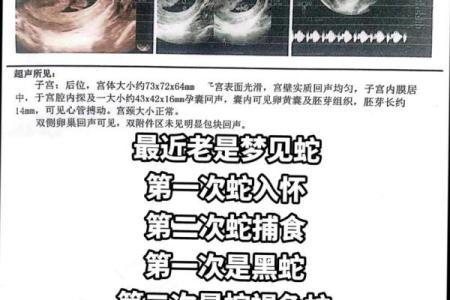 孕妇梦到小黑蛇