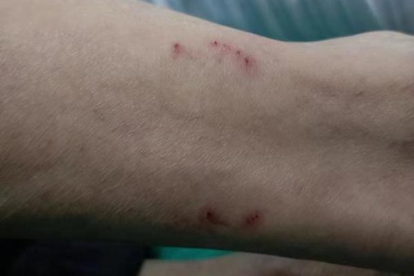 已婚男人梦见被蛇咬是什么意思