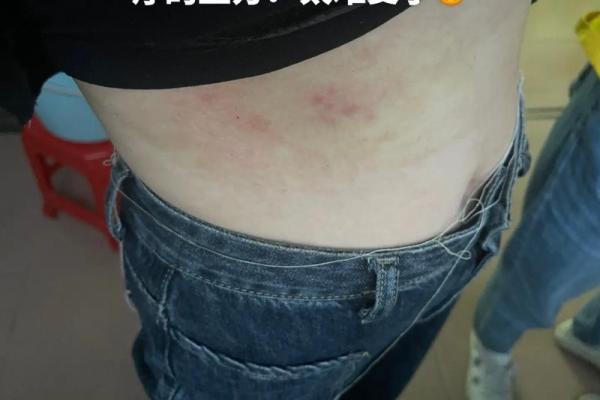 梦到蛇缠脖子是什么征兆 女性