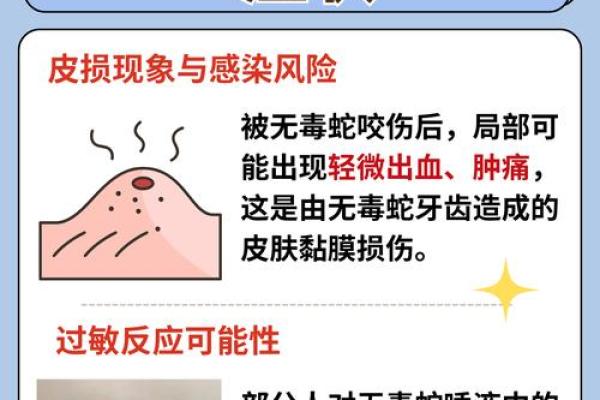 梦见被小青蛇咬了是什么征兆