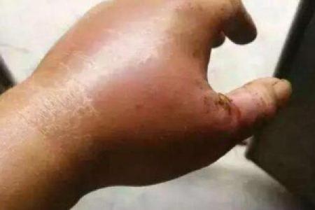 梦到被很多蛇咬是什么征兆 女性